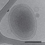 A cryo-electron tomography image of an ultra-small bacteria